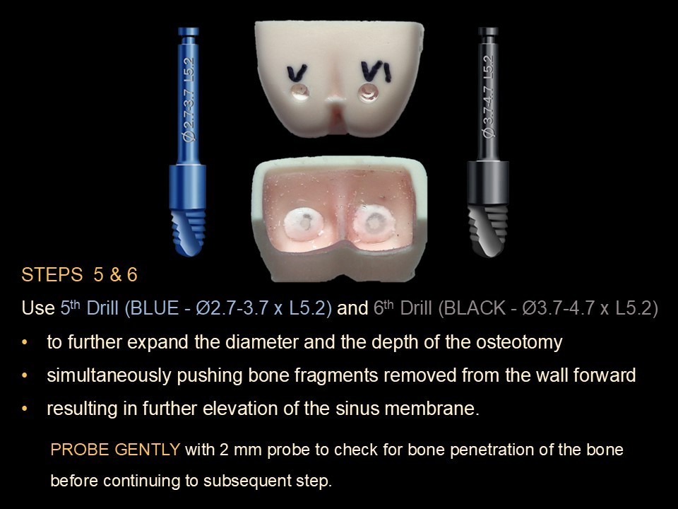 Lateral Window Sinus Elevation Drill Set, with elevator instrument set