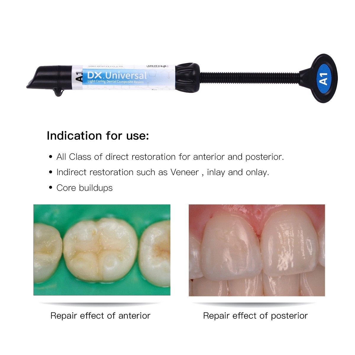 AZDENT Dental Orthodontic Intraoral Photographic Occlusal Glass Mirror 2 Sided