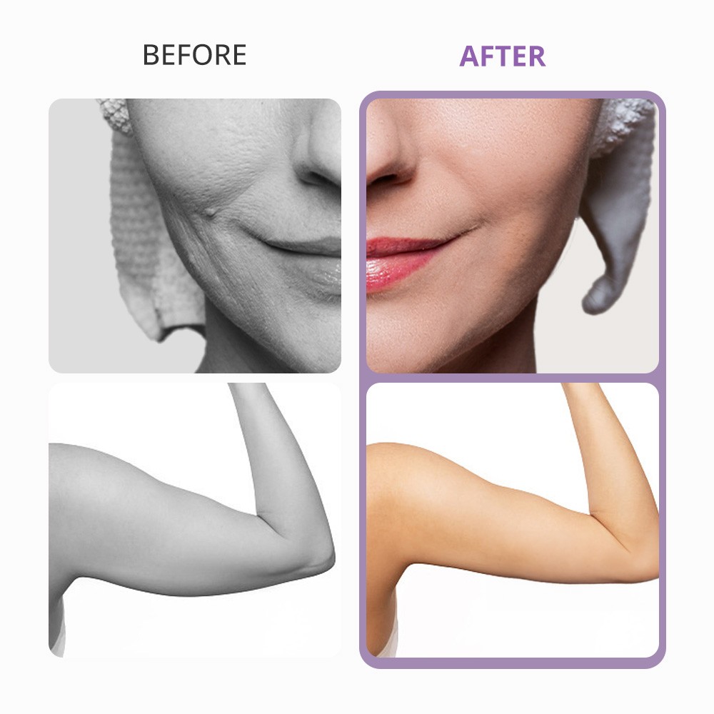 5 in 1 Beauty Machine for Body Massage Facial Skin Care Skin Lifting Lost Weig8
