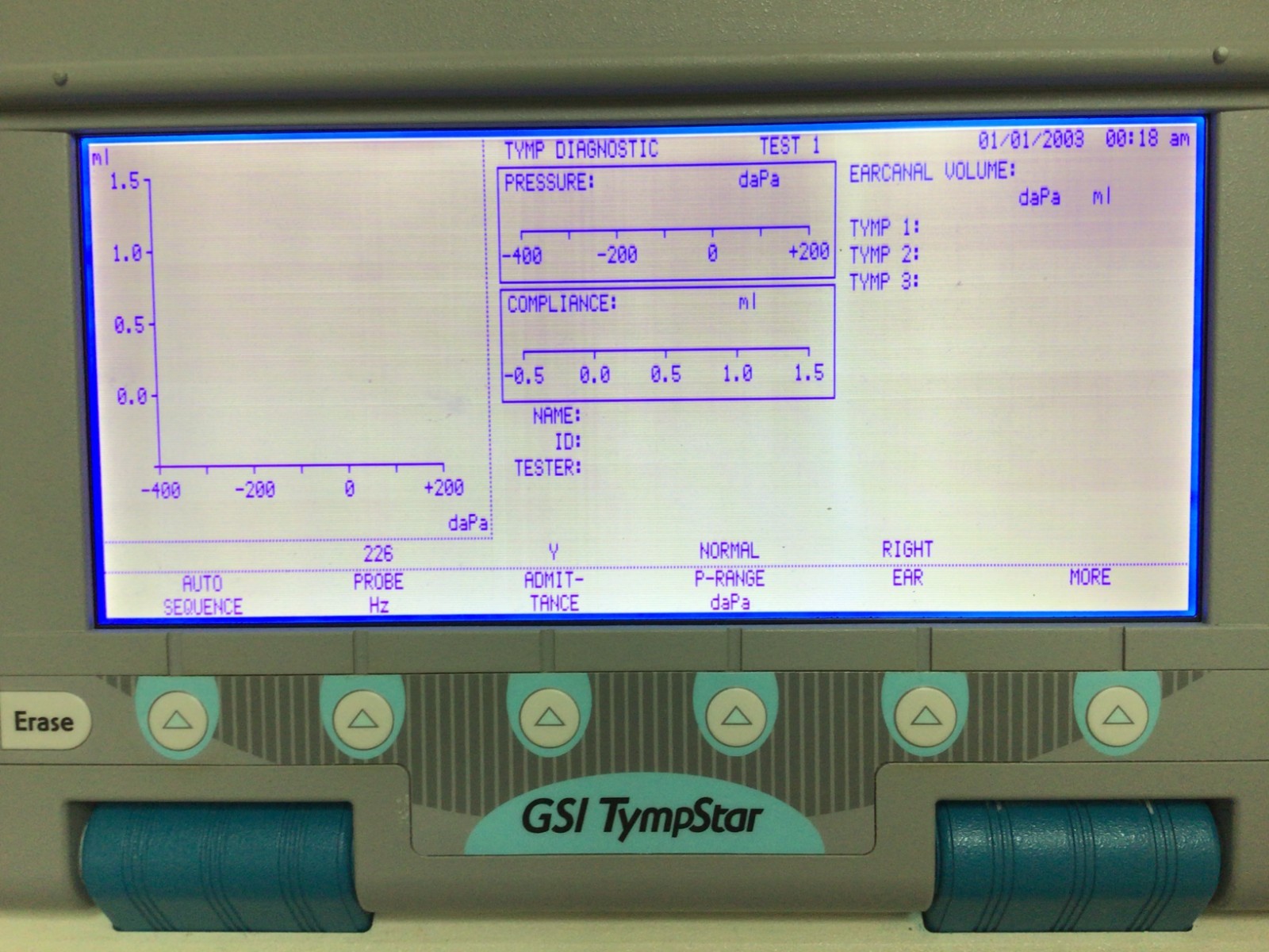 GRASON-STADLER GSI Tympstar Tympanometer Middle Ear Analyzer