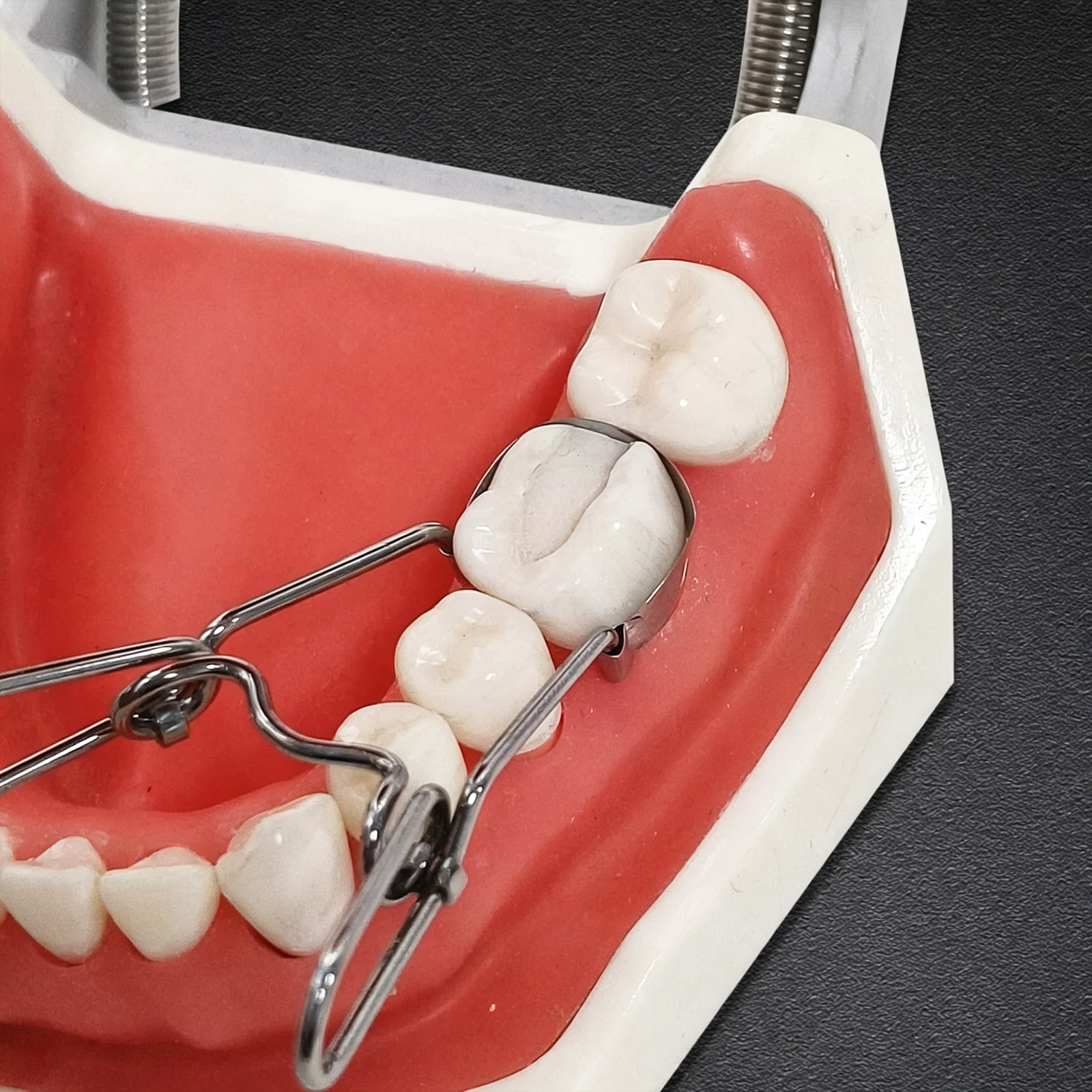 Dental saddle-shaped Matrix Band Fit Garrison Palodent V3 System