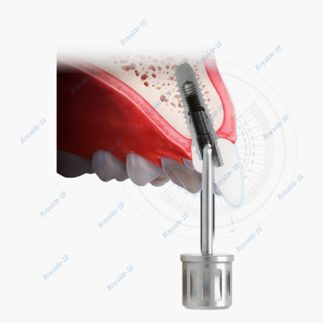 Dental Angled Implant Screwdriver Angulated Screw Channel Driver ASC ITI 1.25