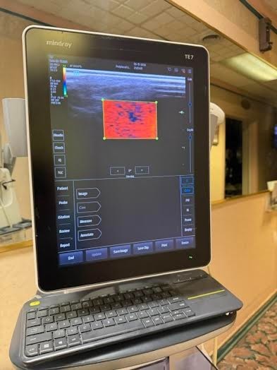 MINDRAY TE 7 ultrasound with two probes