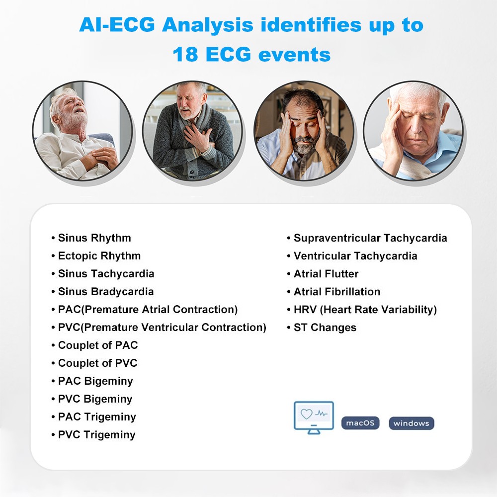 AI Holter Monitor 24 Hrs Chest Strap EKG Monitor with Free AI Analysis PC Report