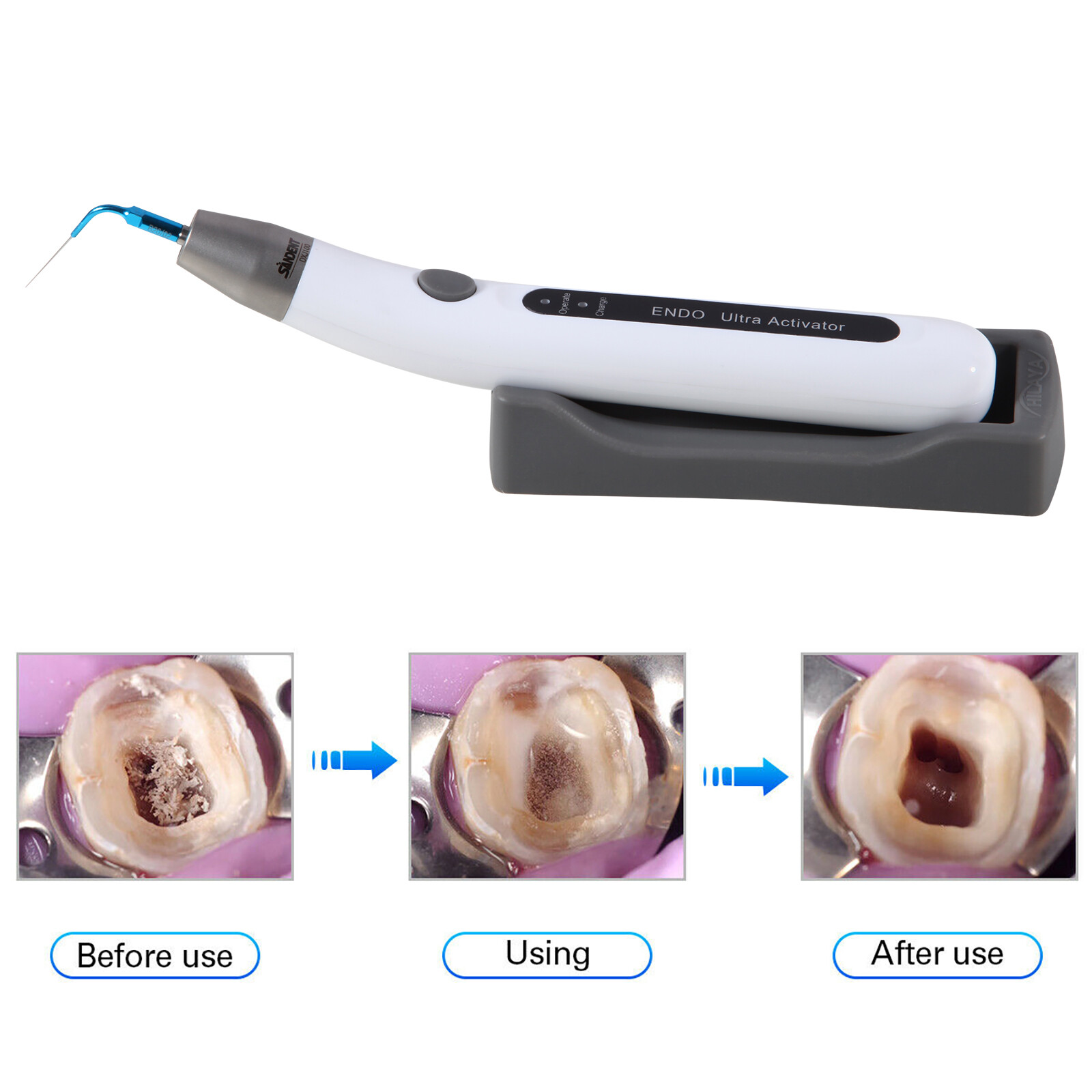 Endo Ultra Activator Dental Ultrasonic Root Canal Irrigator Handpiece 6 Tips DL