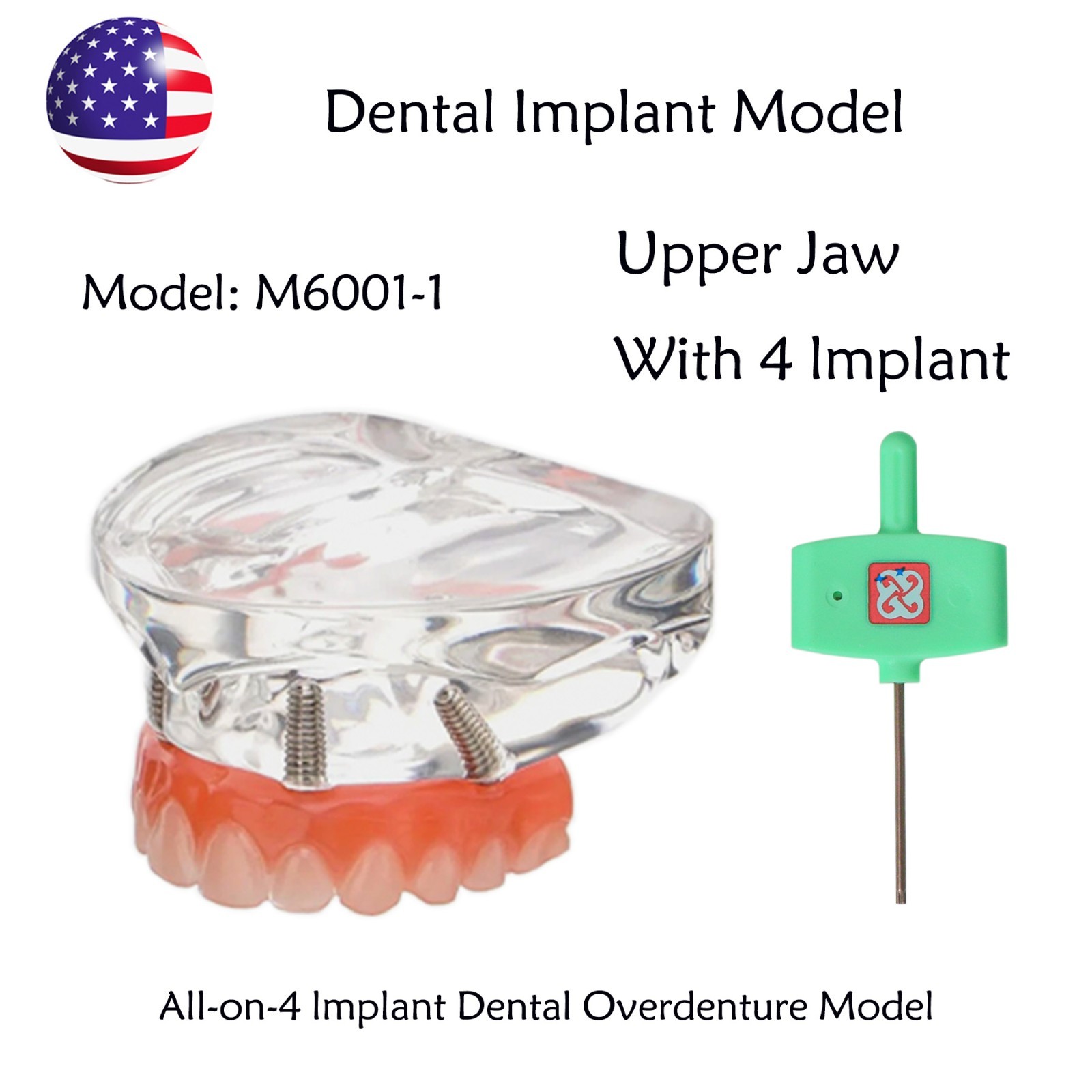 US Dental Implant Overdenture Model All-on-4/6 Upper Jaw Restoration 4/6 Screws