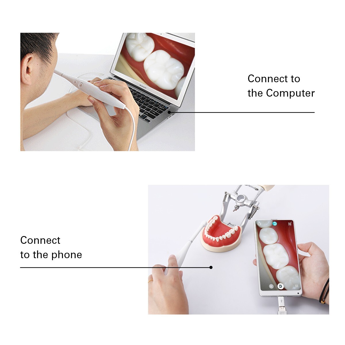AZDENT Dental USB Intraoral Camera 8 LED Oral Endoscope 3-Speed Adjustment IPX5