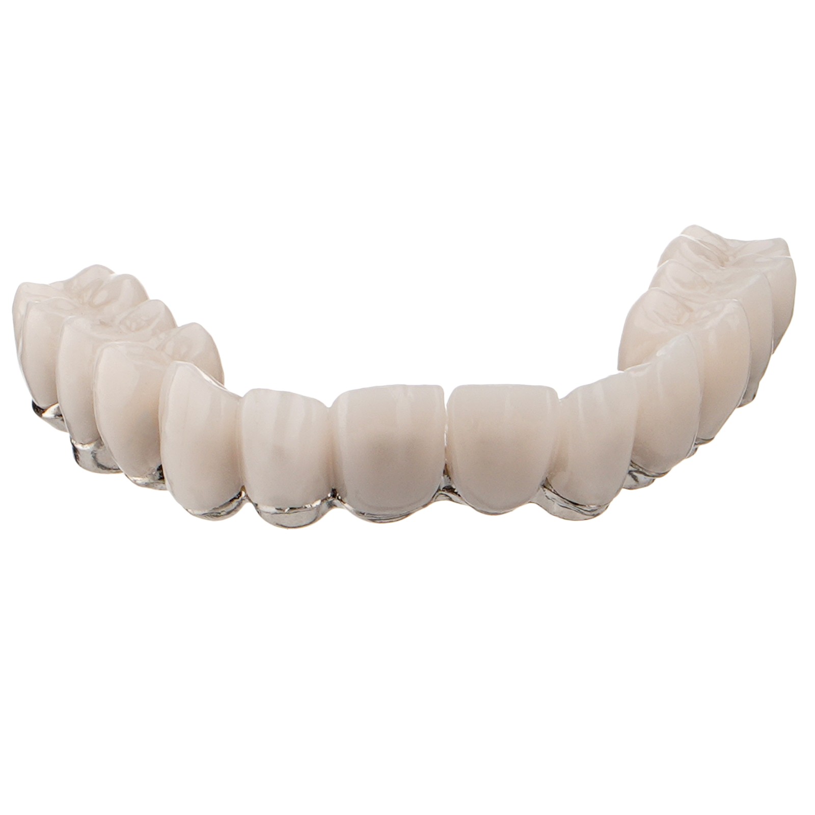 Dental All-on-4 Overdenture Model Upper Jaw Implants Restoration 4 Screws M6023