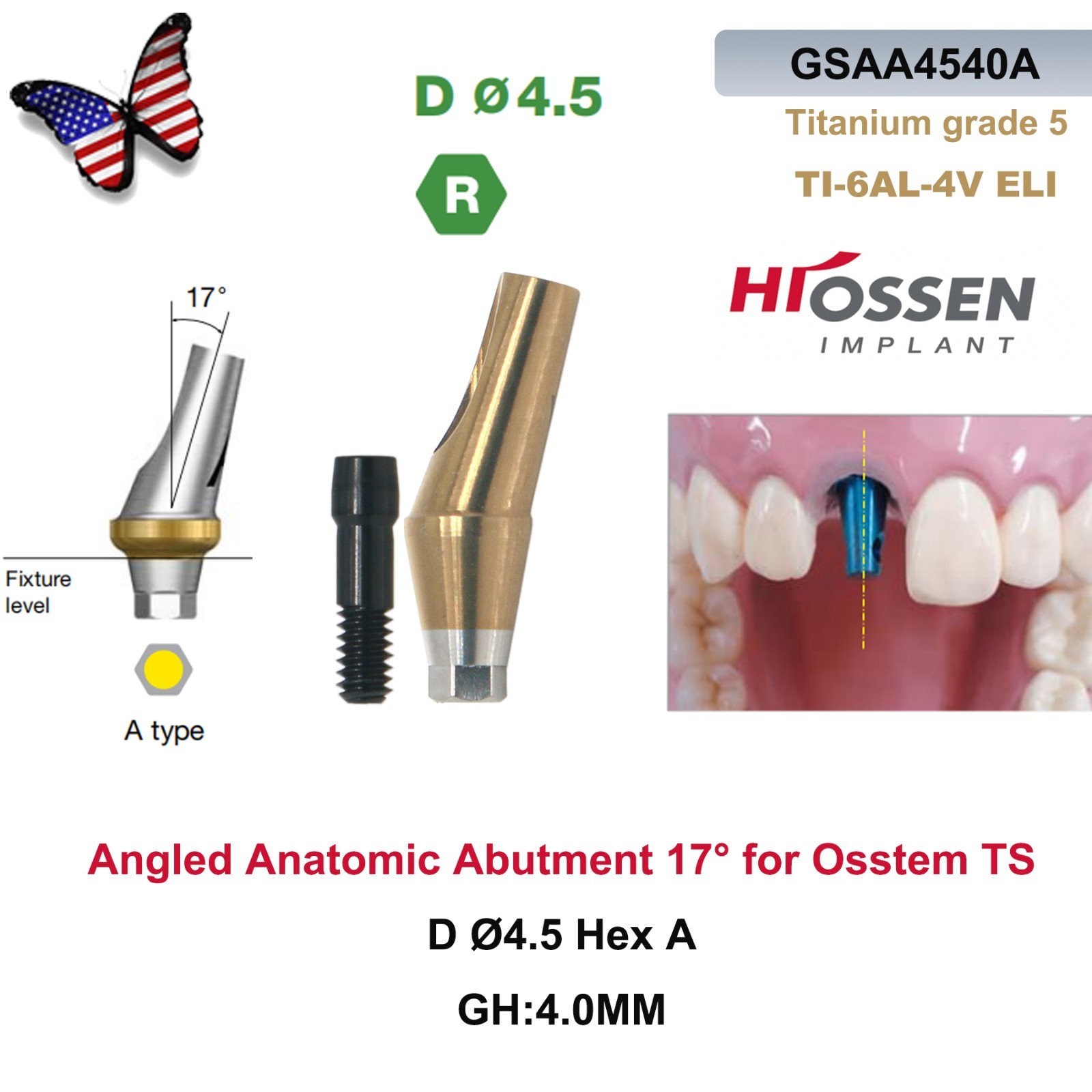 US 17° Angulated Abutment Regular Hex A/B Type For Osstem TS Regular Platform Ti