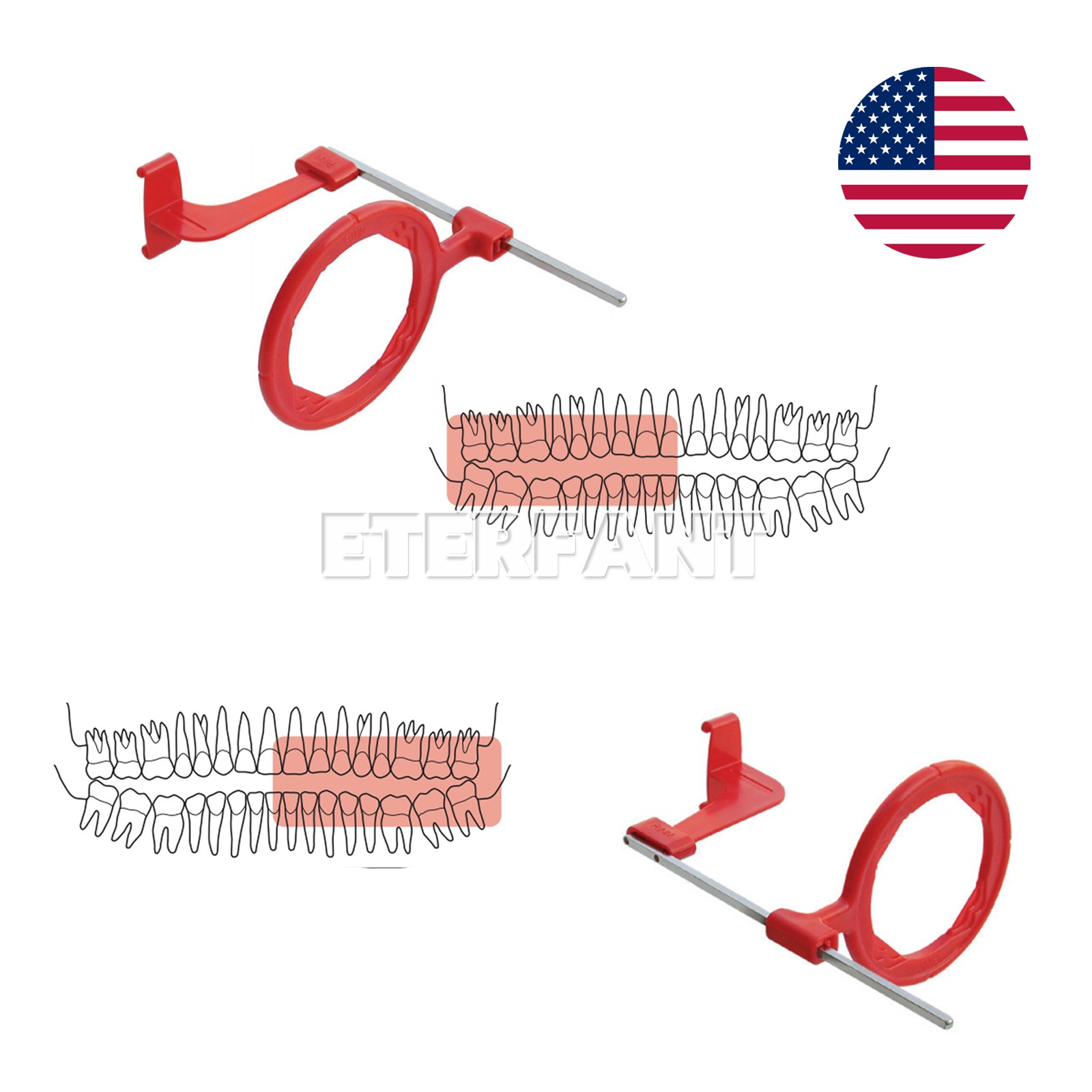 5PCS Dental X-Ray XCP-DS Fit Anterior/Bite wing/Posterior/Endodontic Arm Kit