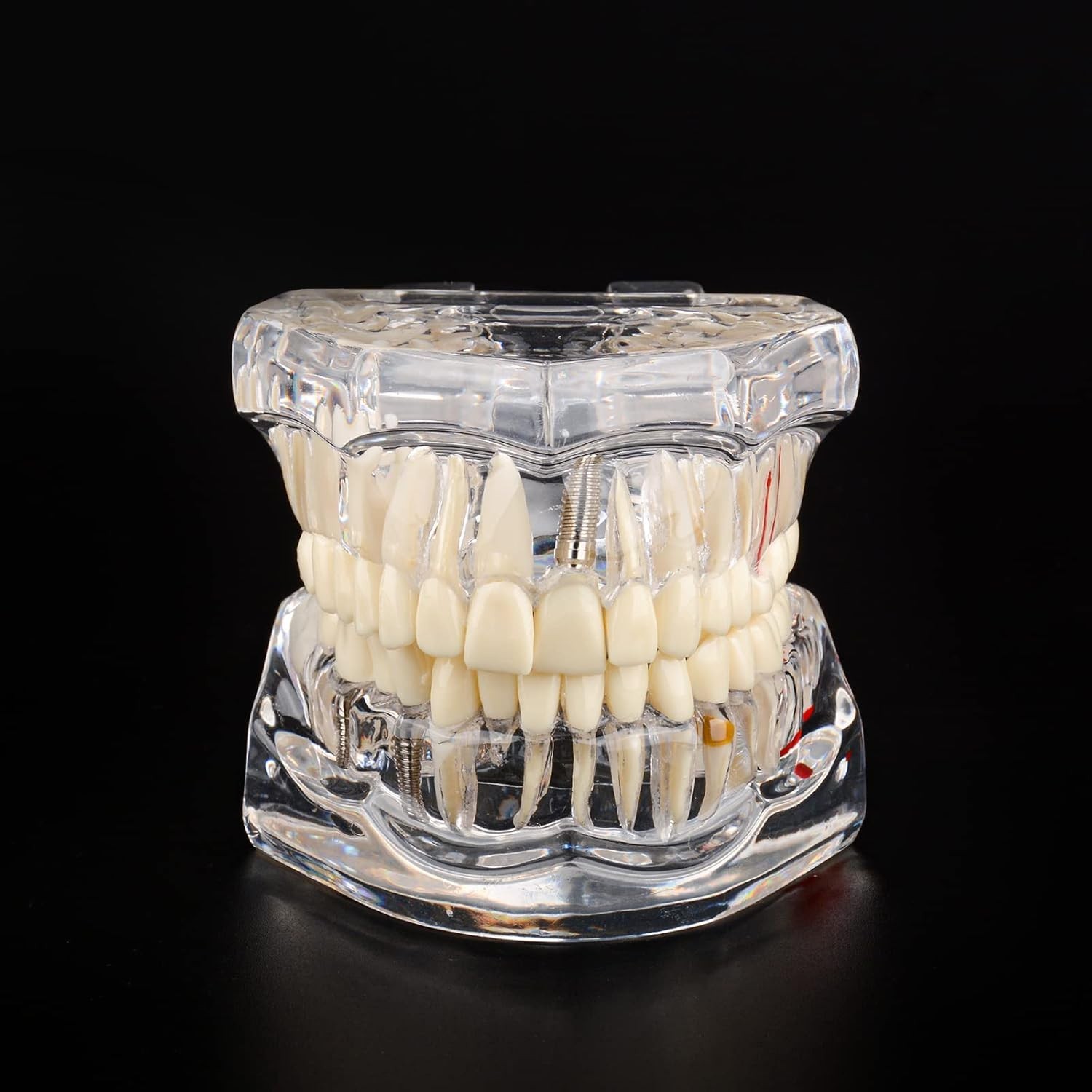 Dental Teaching Tool with Removable Teeth