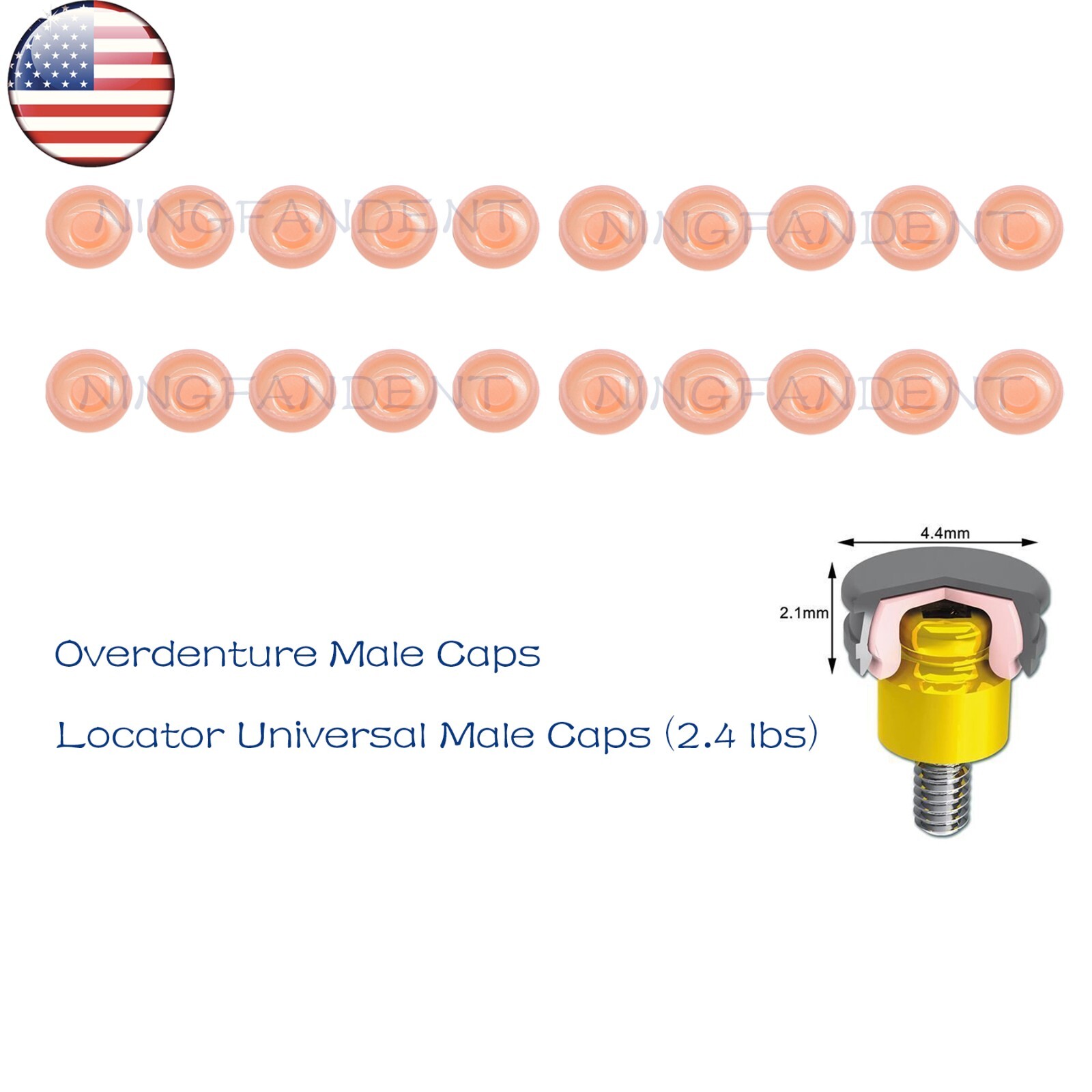US Dental Locator Overdenture Abutment Retention Cap Male caps Inserts set