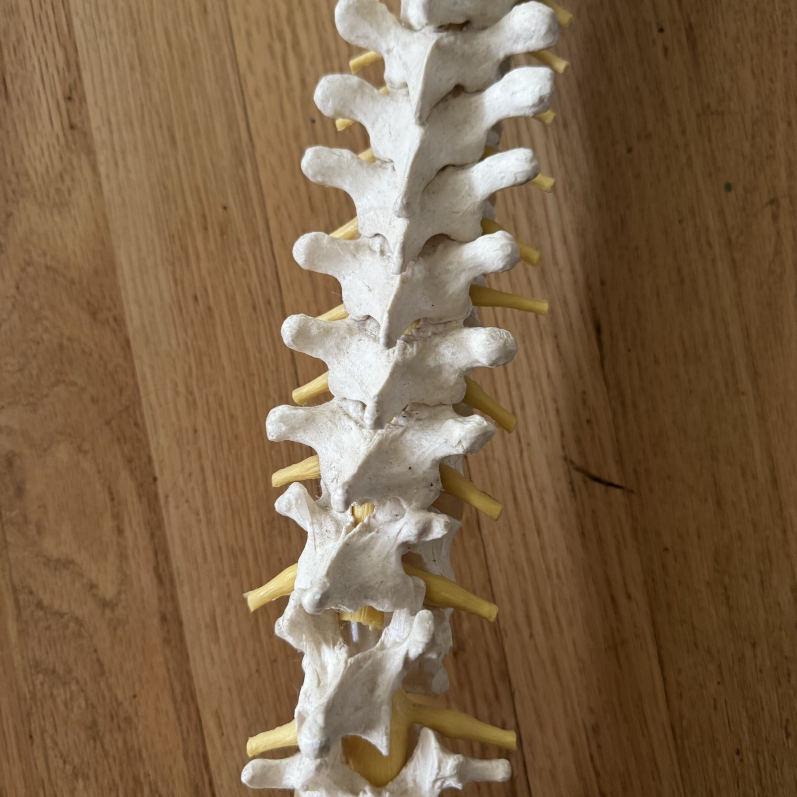 MEDICAL MODEL SPINE BACKBONE WITH PELVIS HIPS ADULT SIZE GERMANY SCIENTIFIC