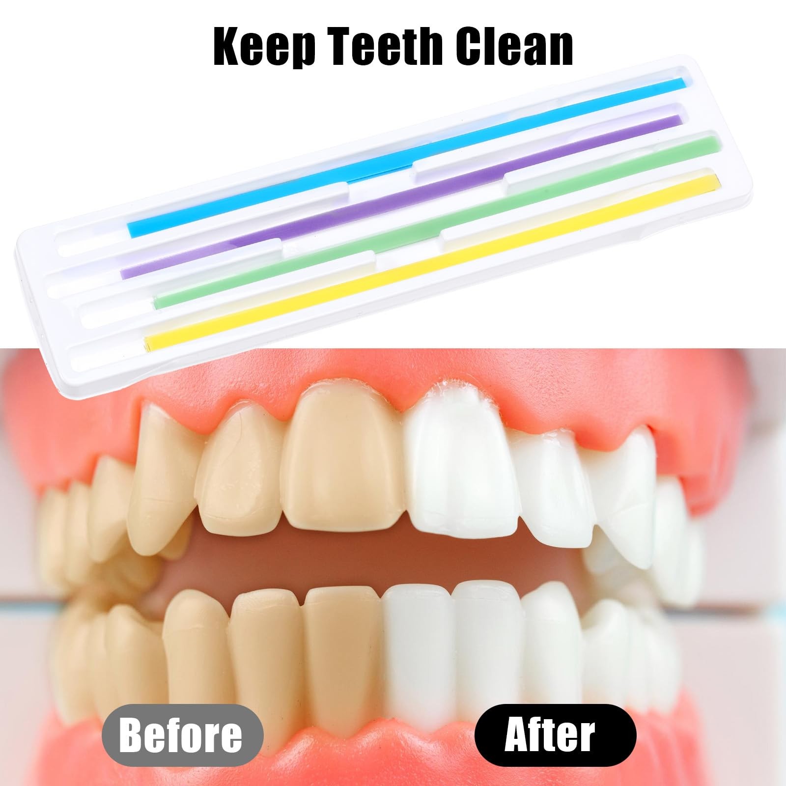 Hpmjz 60 Pcs Dental Polishing Strips Teeth Sanding Grinding Tool Universal…