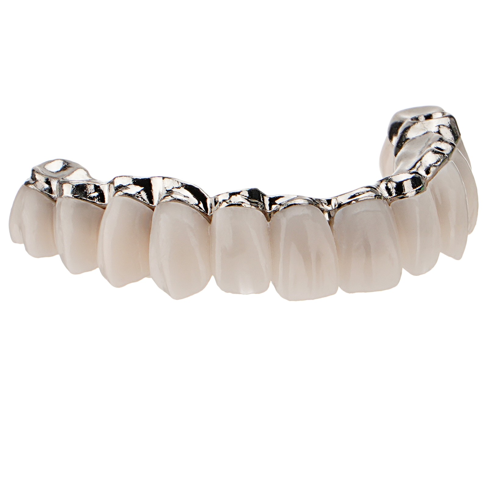 Dental All-on-4 Overdenture Model Upper Jaw Implants Restoration 4 Screws M6023