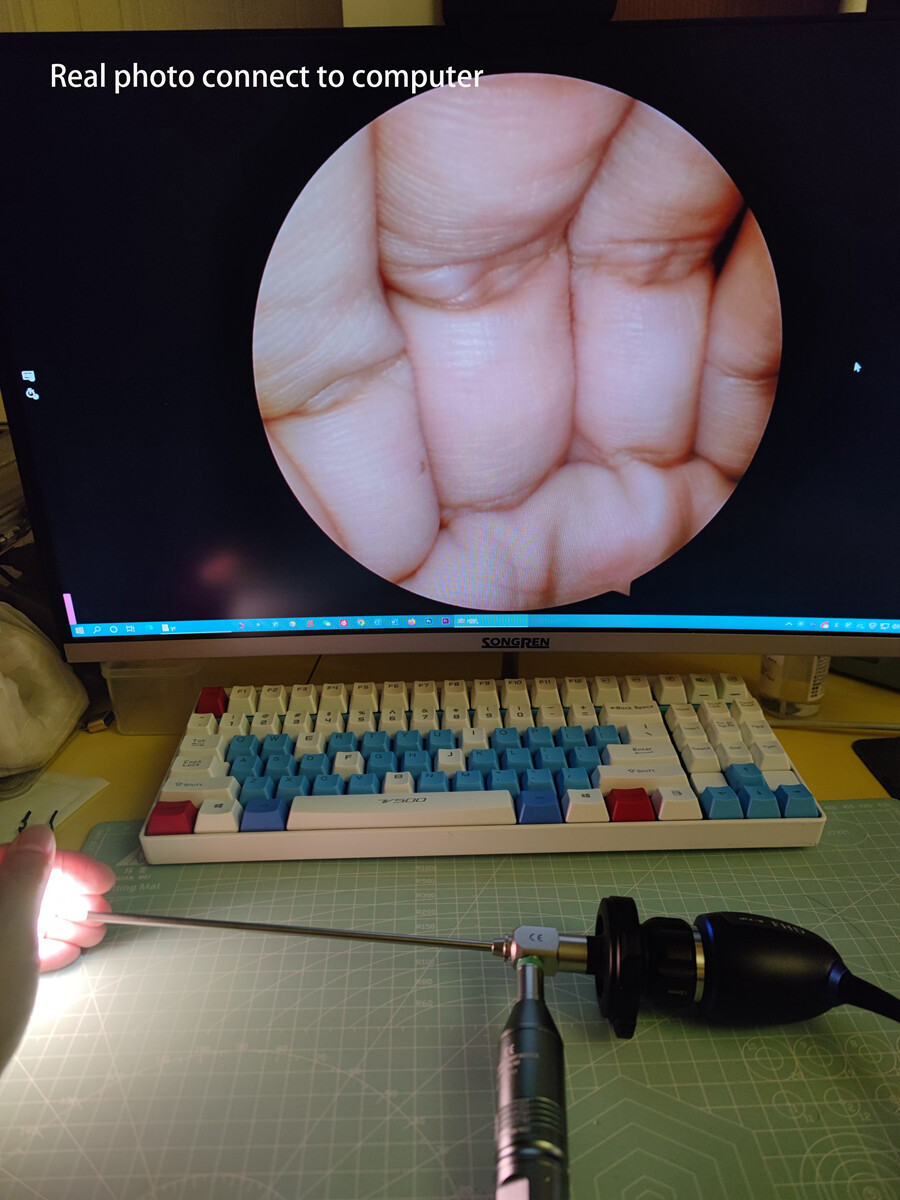 Portable Medical Endoscope HD 1080P USB Camera With 60FPS Frame Rate