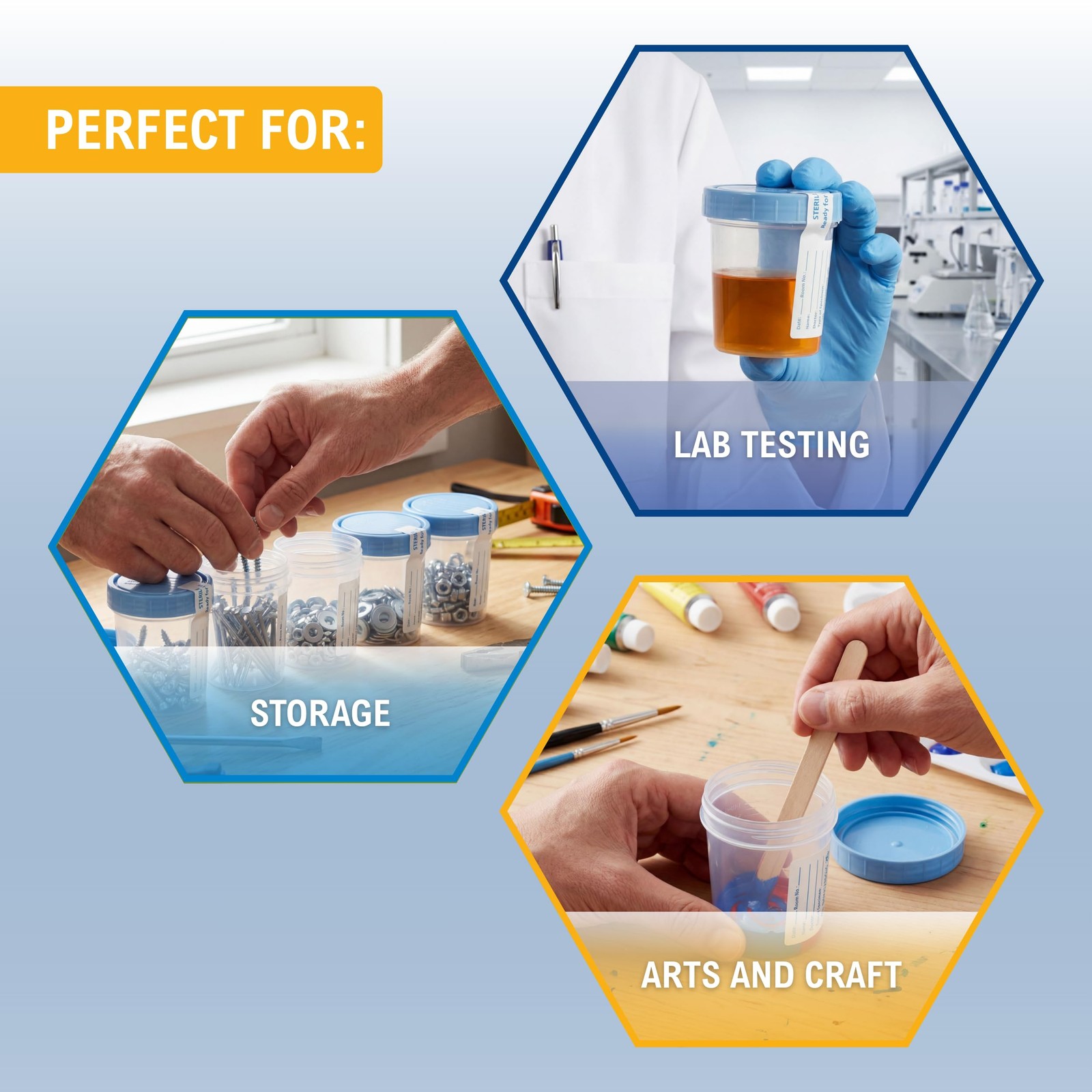 MED PRIDE Disposable Specimen Cups 10-Pack| High-Grade Silicone, Sterile,…