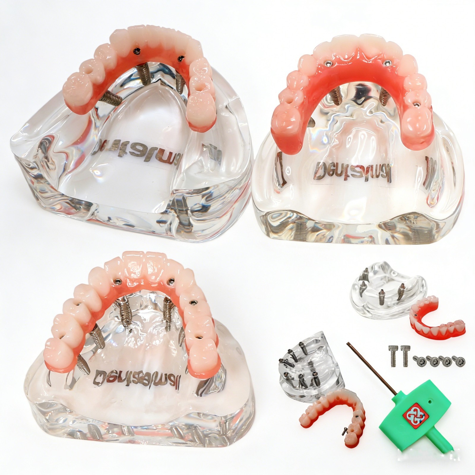 Dental Implant Model Upper Lower Jaw Demo All on 4/6 Overdenture treatment model
