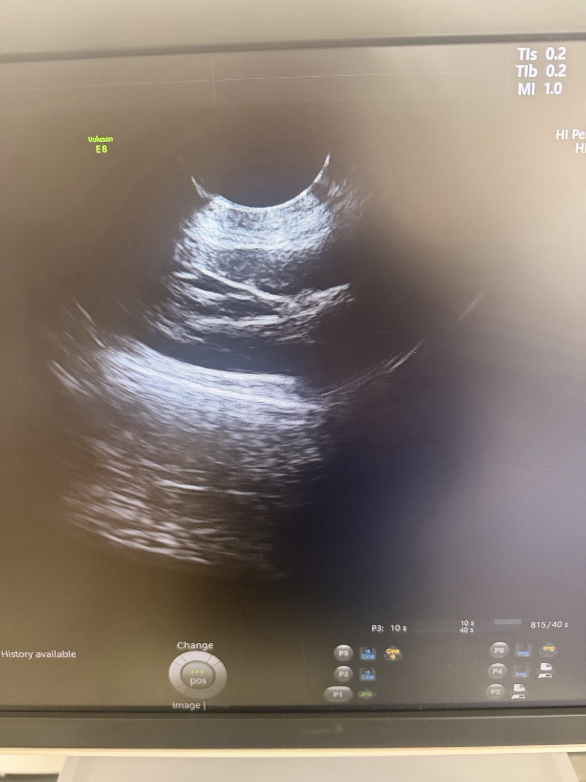 2020 GE Voluson E8 BT21 4D Ultrasound | HDlive | Free Probe | 90-Day Warranty