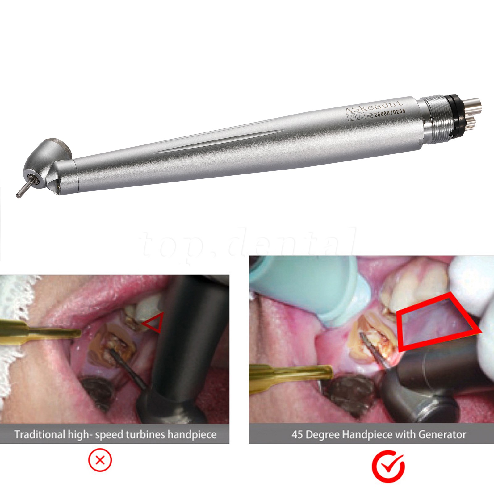 LED Dental Surgical Handpiece 45 Degree High Speed Turbine 4 Hole Rare Exhaust