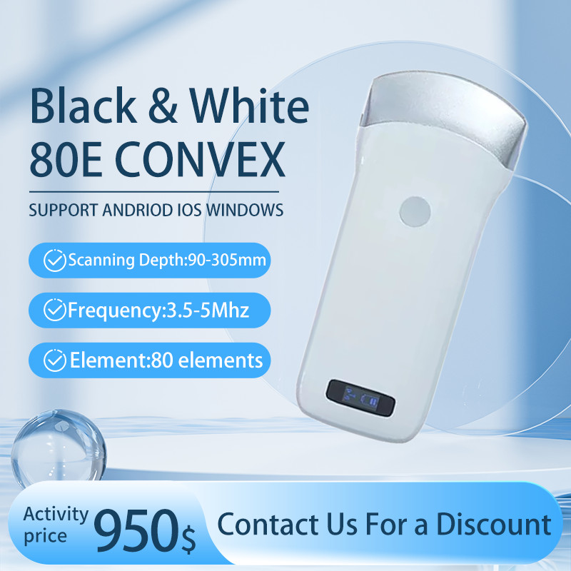 Wireless Ultrasound Probe Scanner Portable Machine Support iOS Android Windows