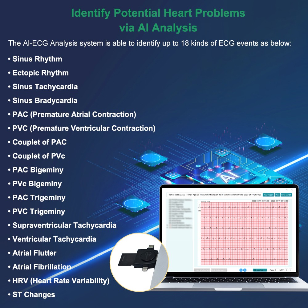 12 lead Holter Monitor 24h Portable with AI analysis software for Mac & Windows
