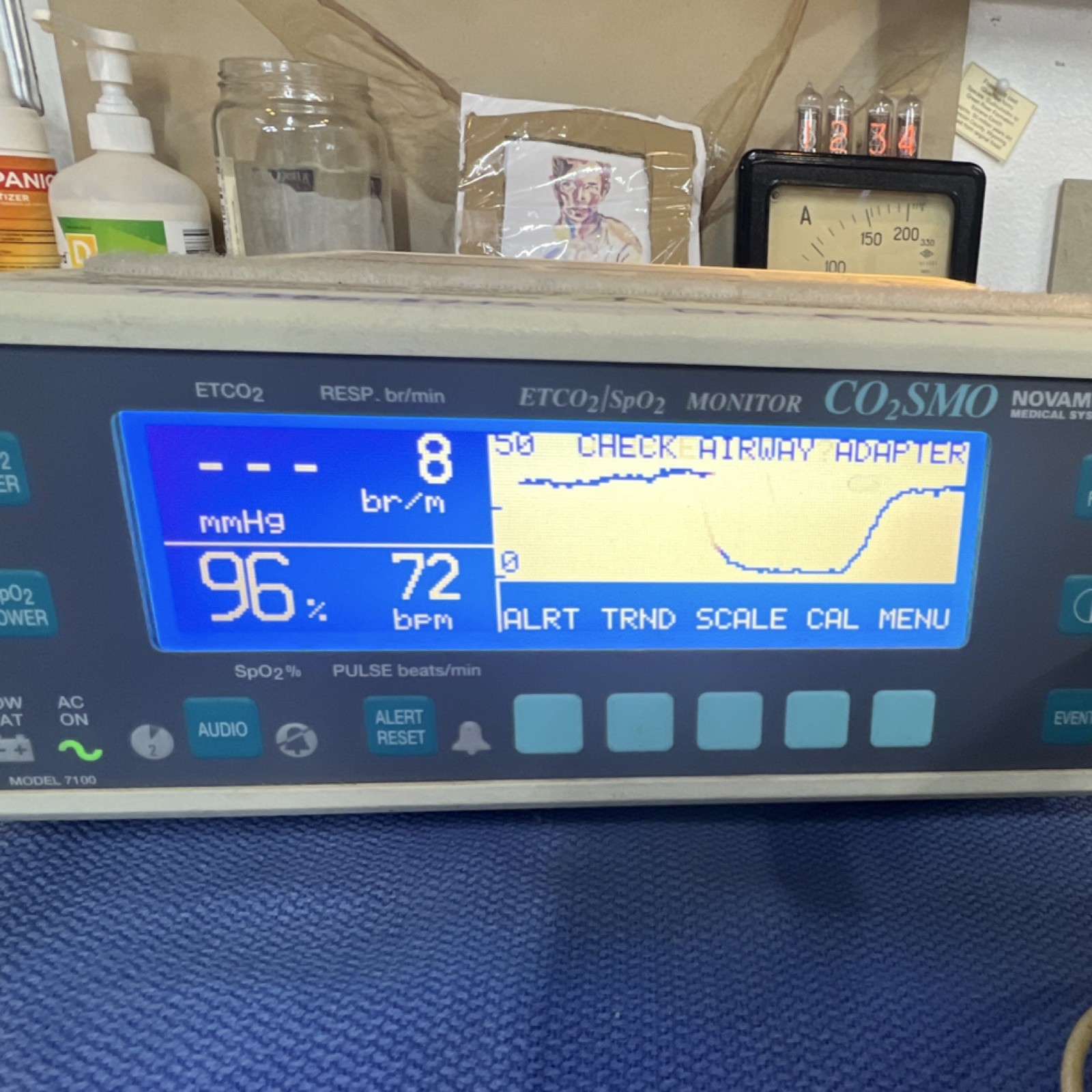 Novametrix CO2SMO 7100 ETCO2 SpO2 Respiration Monitor Battery Operated Printer