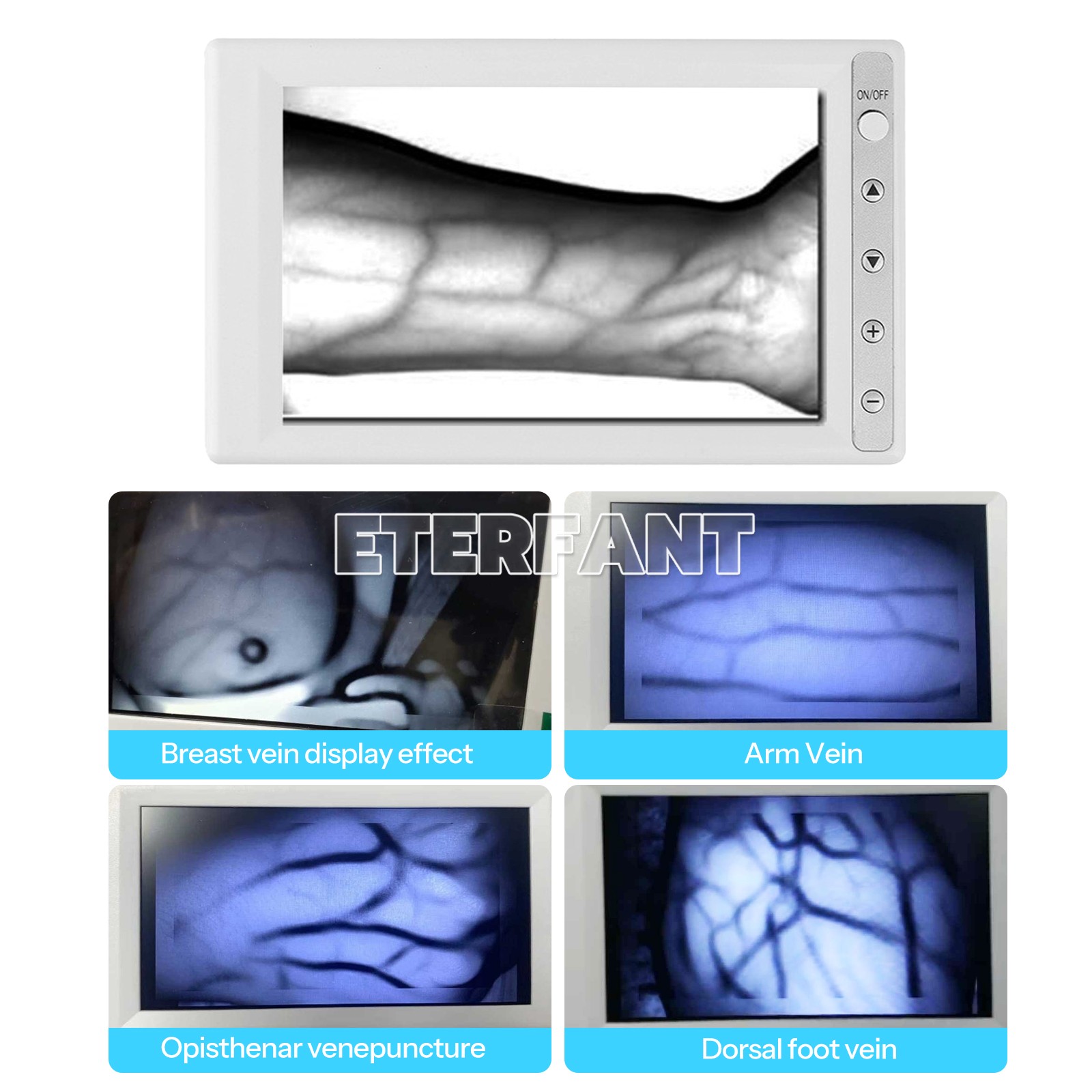 ETERFANT AV300 Vein Finder Blood Vessel Searching Machine 5.5” LCD Screen