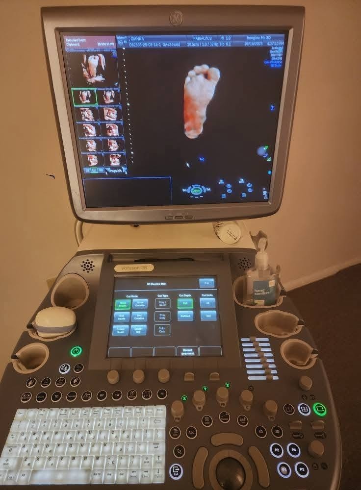 3D/4D/HD GE Voluson E6 Ultrasound Machine Pickup or Ship (at purchasers expense)