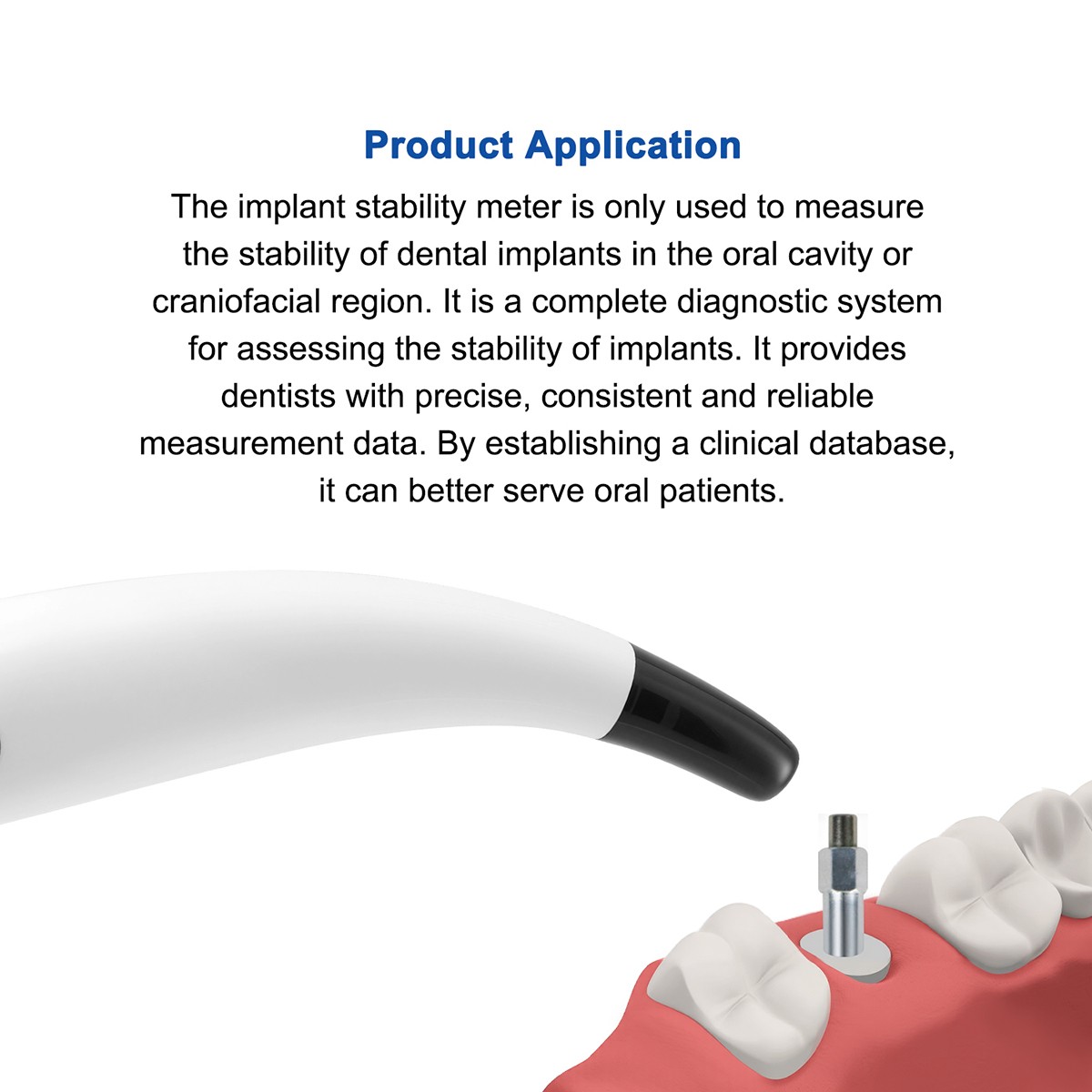 Dental Ortho Composite Ceramic Lingual Buttons for Bondable Round Base