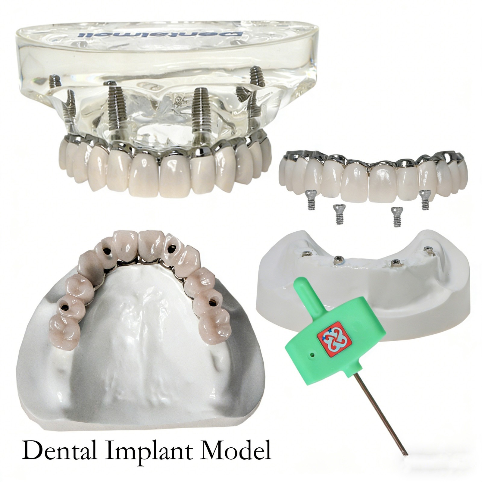 Dental Implant Model Upper Lower Jaw Demo All on 4/6 Overdenture treatment model