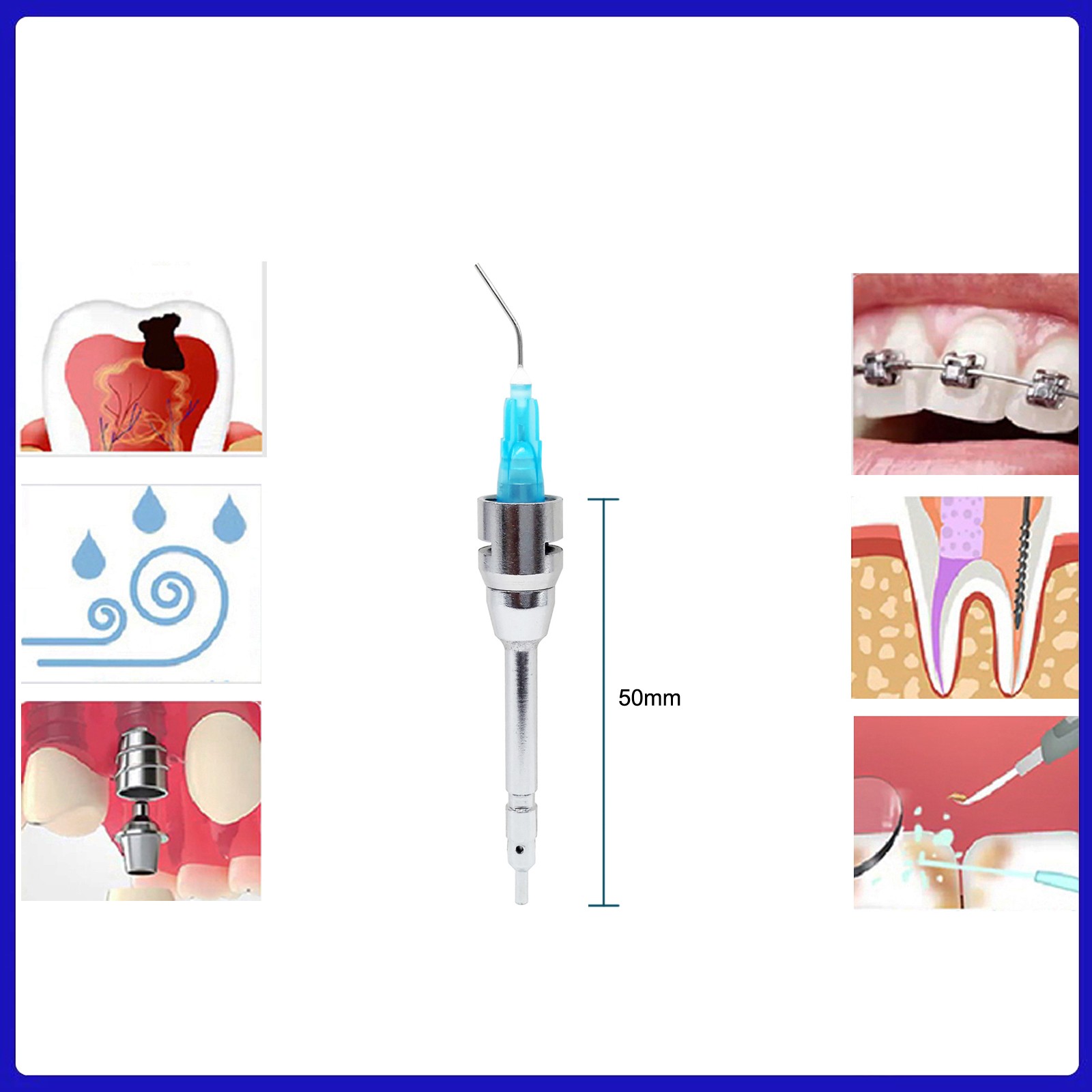 Short Dental Kerr Stropko Style Air Water Irrigator Irrigation Tip 3-Way