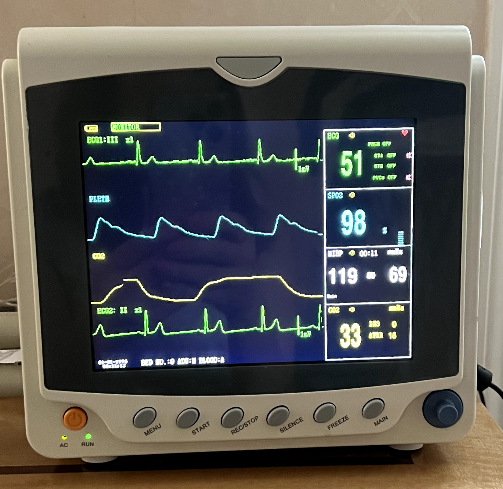 Patient Multiparameter Vital Signs Monitor with ETCO2
