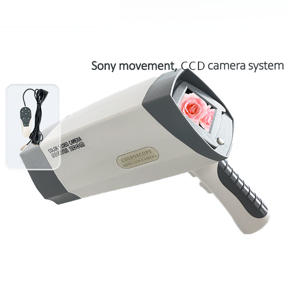 Electronic Digital Colposcope – Gyn, LCD Display & Diagnosis Software