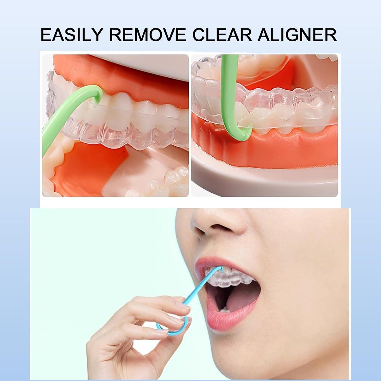 5PCS Aligner Removal Tool,5 Colors Clear Aligner Remover Tools for Invisalign…