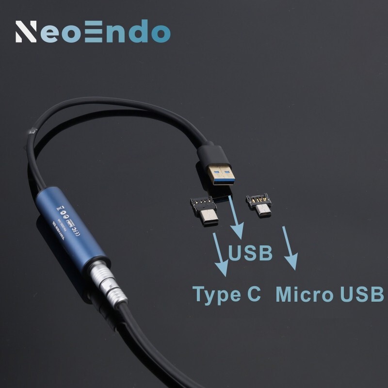 Portable Full HD 1080P Medical Endoscope Camera for ENT Surgery & Inspection