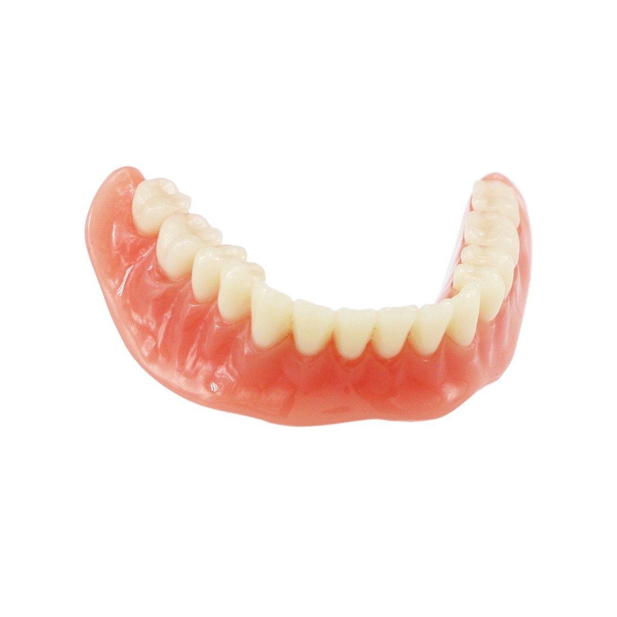 4 Implants Upper Lower Implant Teeth Model Dental Overdenture Restoration Model