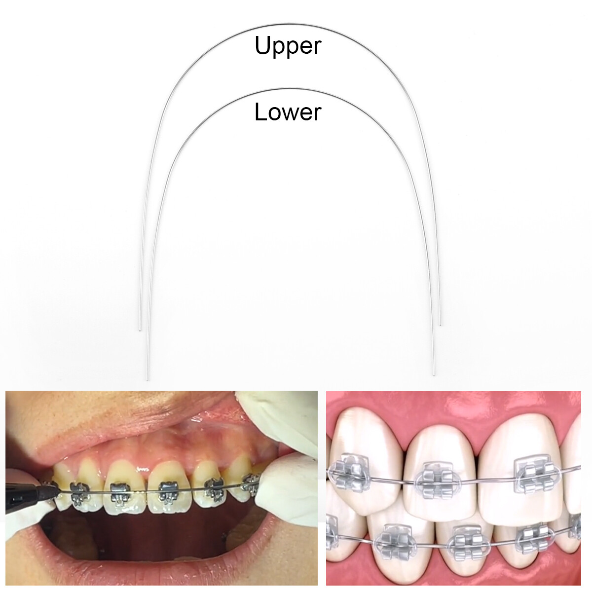 AZDENT Dental Orthodontic Super Elastic Niti Arch Wire Round Natural Nature Form