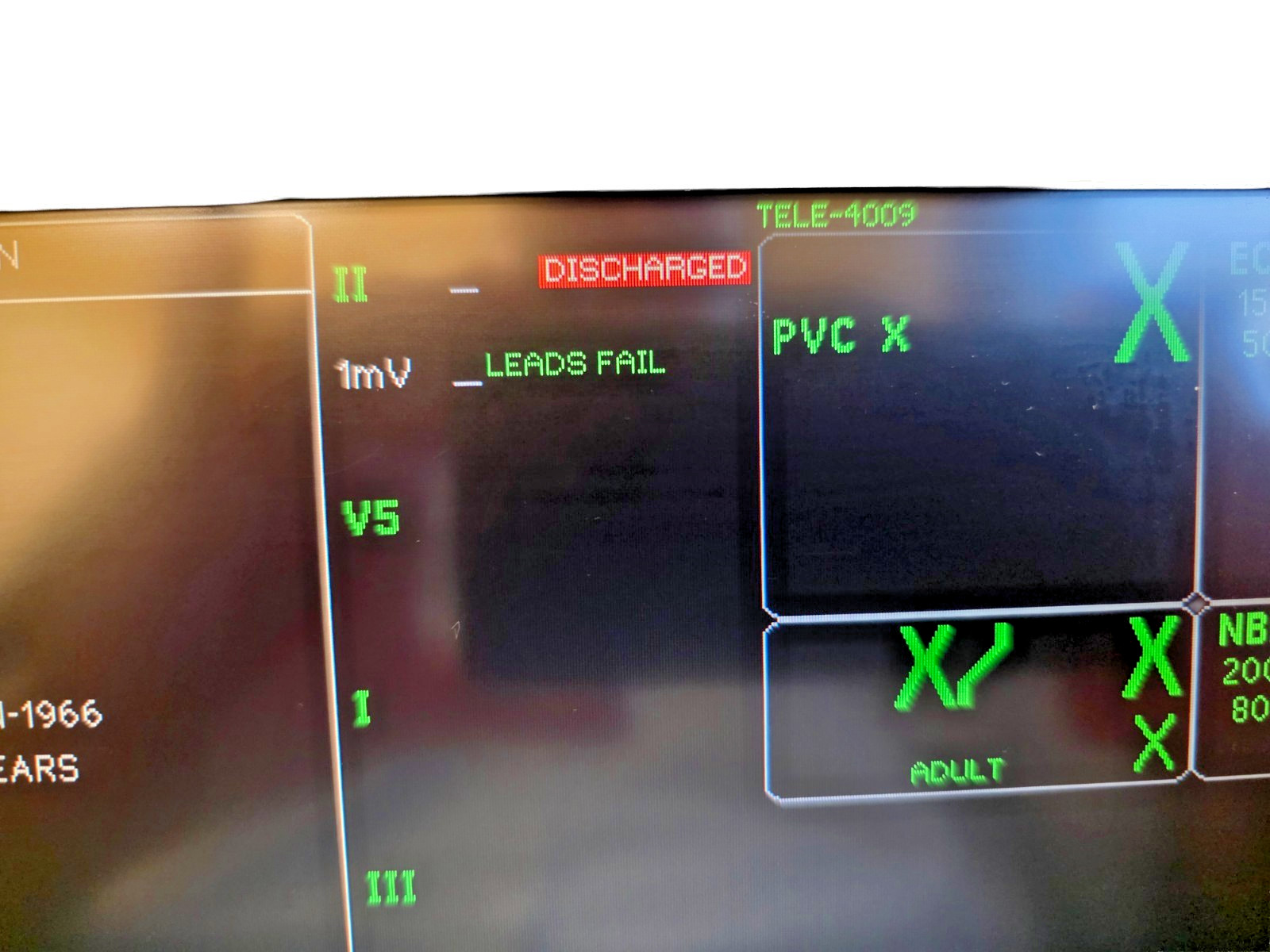 GE Dash 4000 Patient Monitor Vital Signs Hospital Display Powers On w/ Cord