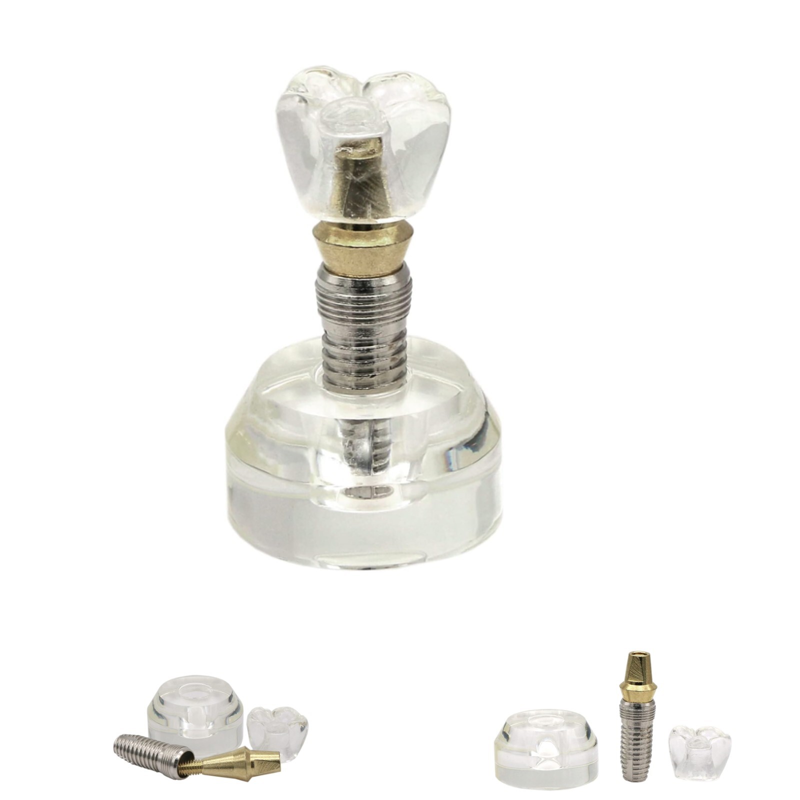 Dental Implant Model Upper Lower Jaw Demo All on 4/6 Overdenture treatment model