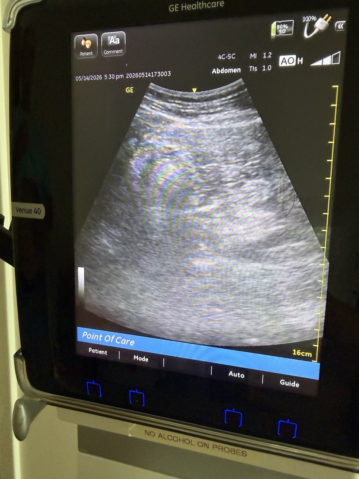 GE Venue 40 Portable Ultrasound Machine w/ 2 Probes + Docking cart 2014