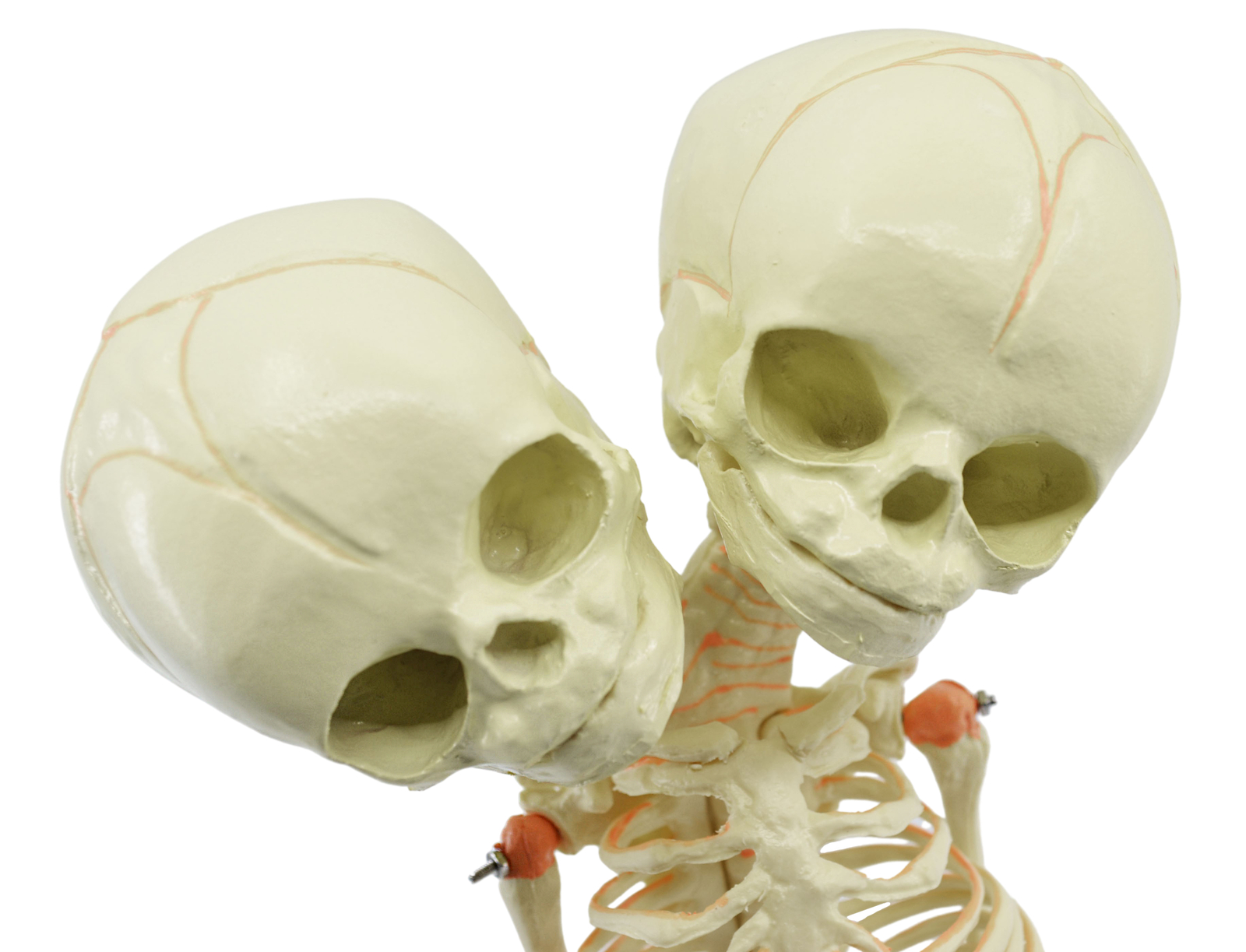 Infant Fetus Skeleton Model, Mini Size – Twin, Conjoined Skull – Eisco Labs