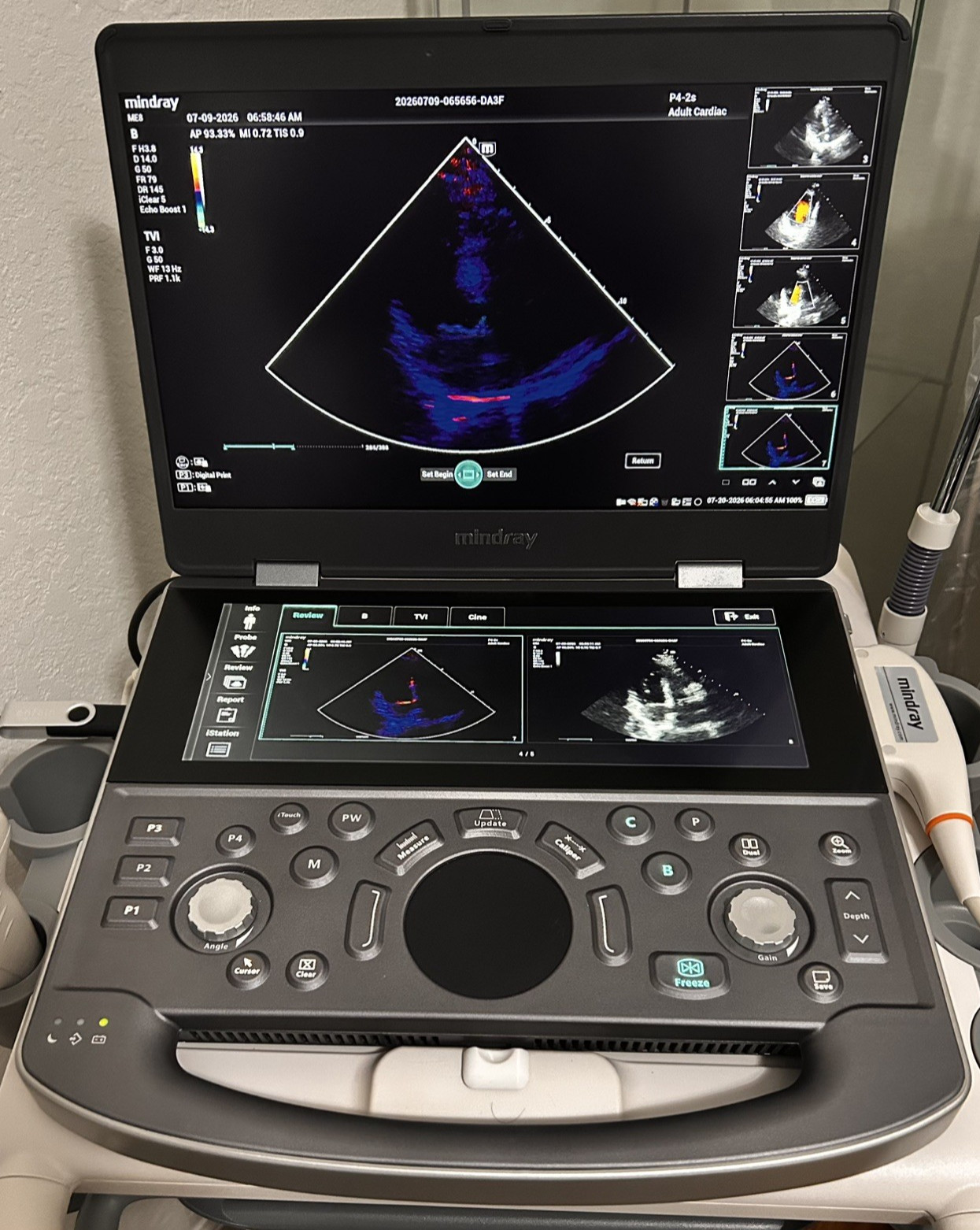 Mindray ME8 2021 with Cardiac Probe and all licensed installed