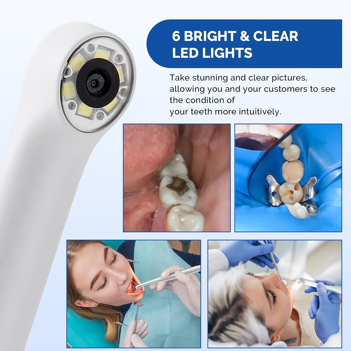 Dental USB HD 720P Intraoral Camera Imaging Intra Oral Endoscope 6 LEDS