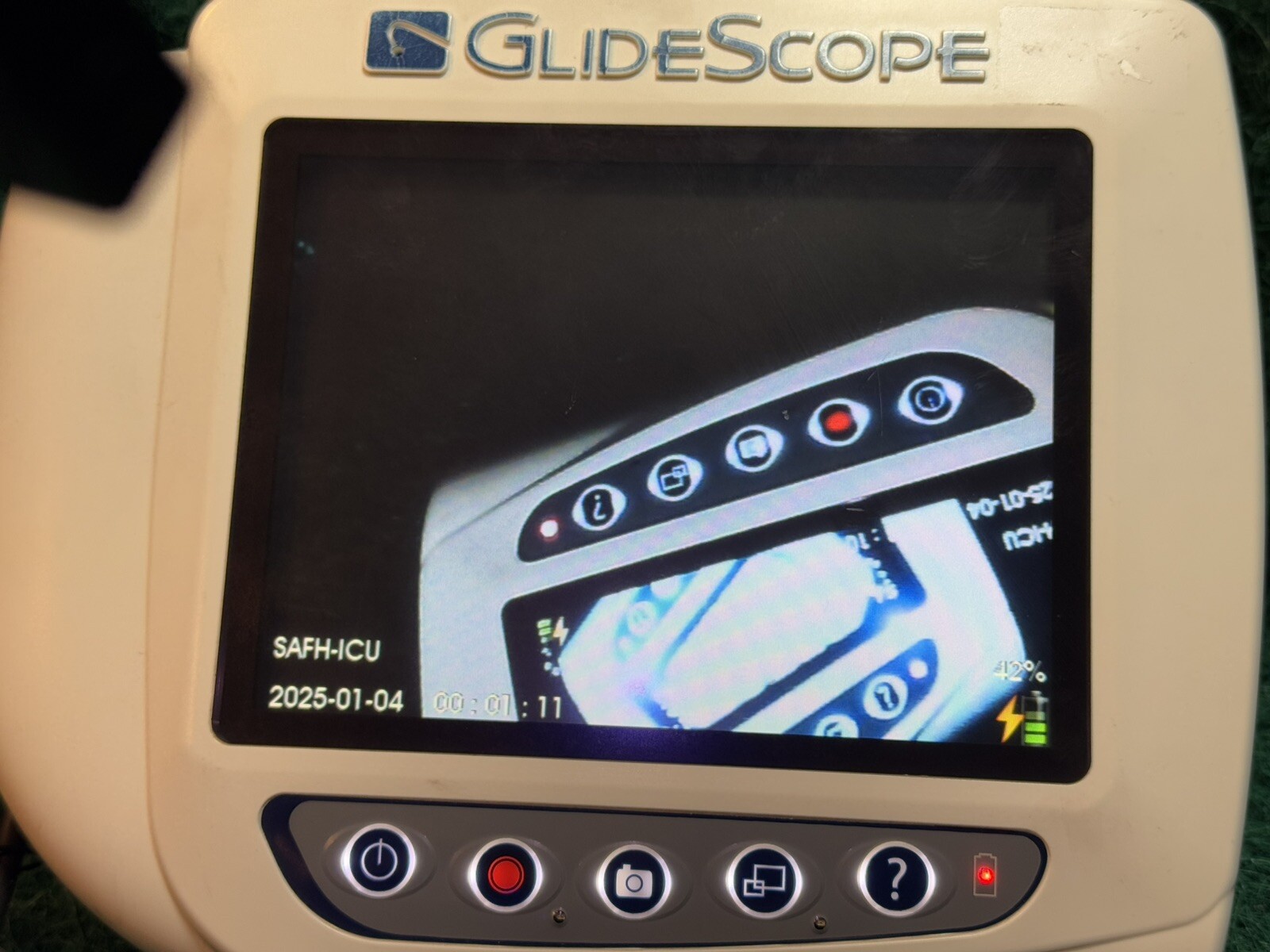 VERATHON AVL 0570-0338 GLIDESCOPE PORTABLE VIDEO MONITOR