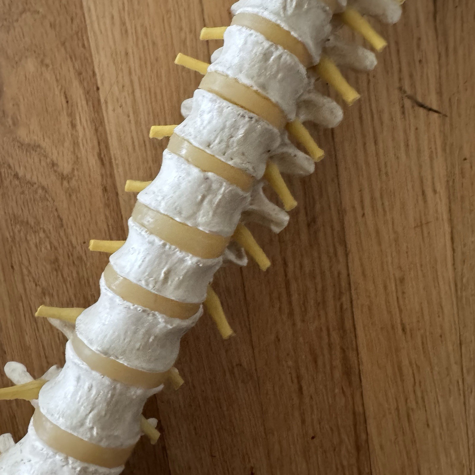 MEDICAL MODEL SPINE BACKBONE WITH PELVIS HIPS ADULT SIZE GERMANY SCIENTIFIC