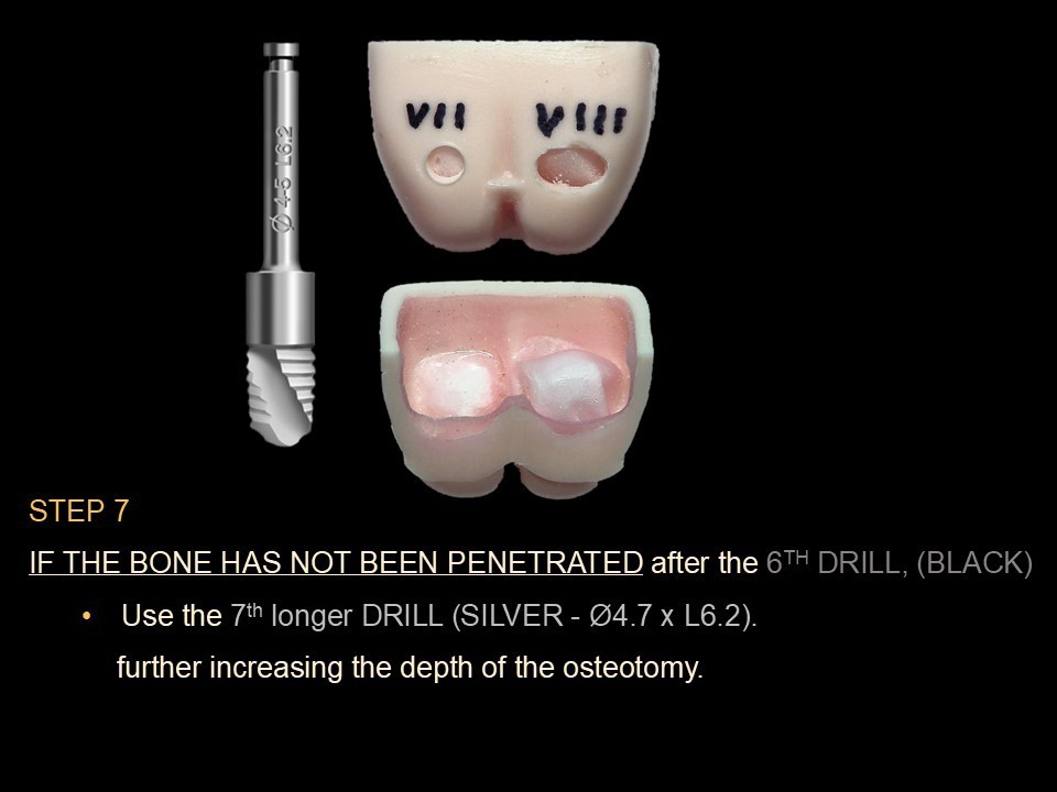 Lateral Window Sinus Elevation Drill Set, with elevator instrument set