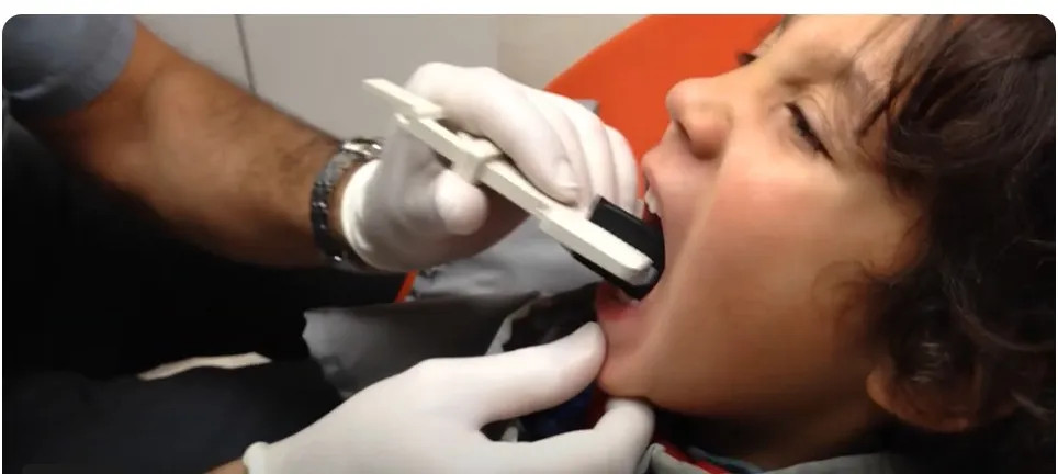 Carestream Insight Ip-01 Pedo X-Ray Film Pediatric Dental Films