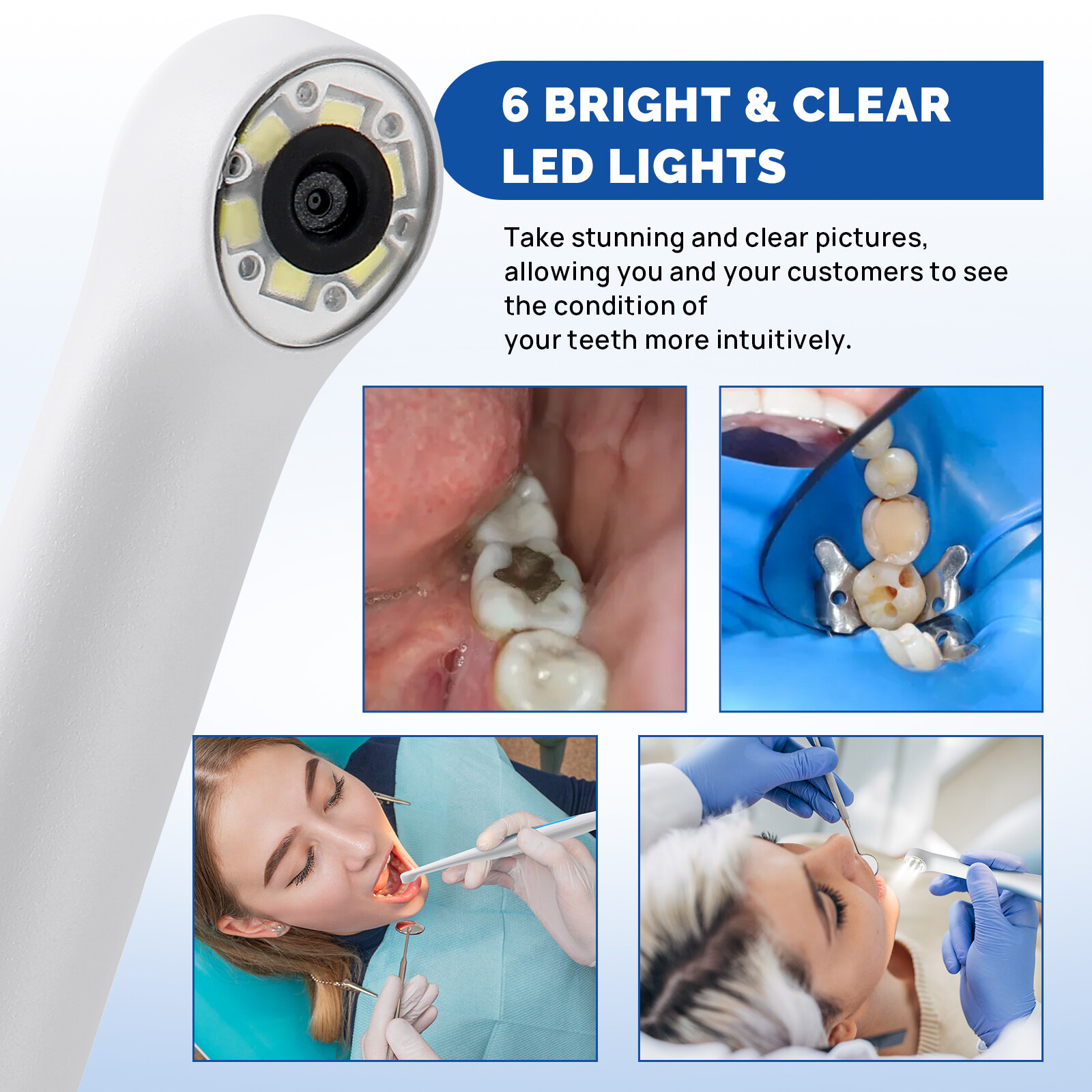 JMU MD-280 Intraoral Camera Dental Camera Capture Button Work on Dexis/Eaglesoft