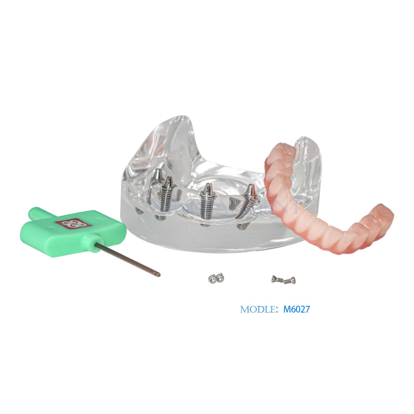 Dental All-on-4 Overdenture Implant Model, Upper/Lower Jaw-Clear,With 4 Screw